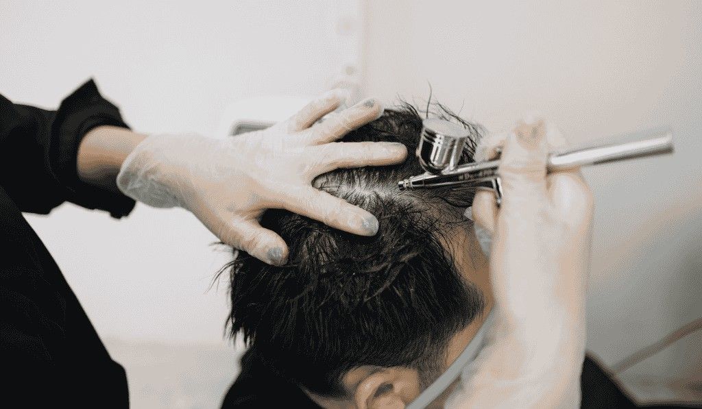 Hair Restoration Treatment Cost in Bangalore