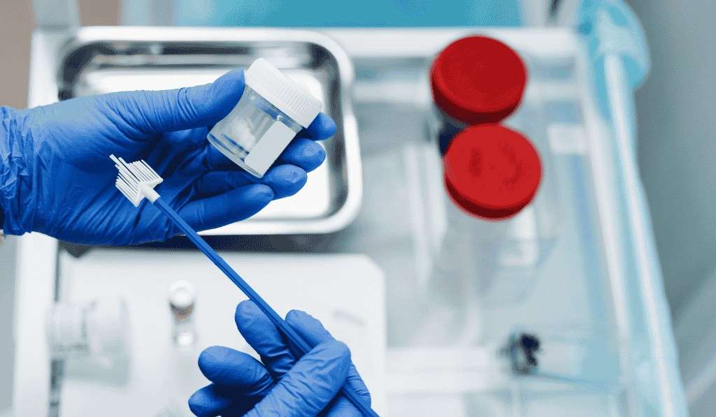 Cervical Cancer Screening Pap Smear vs HPV Test